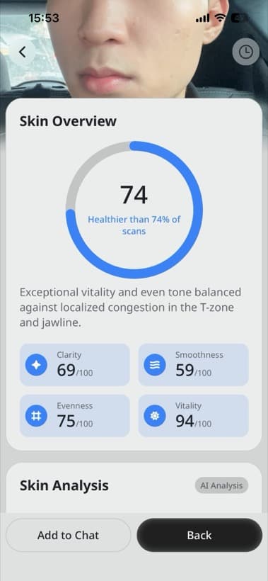 Skin Overview face-scan score and category results